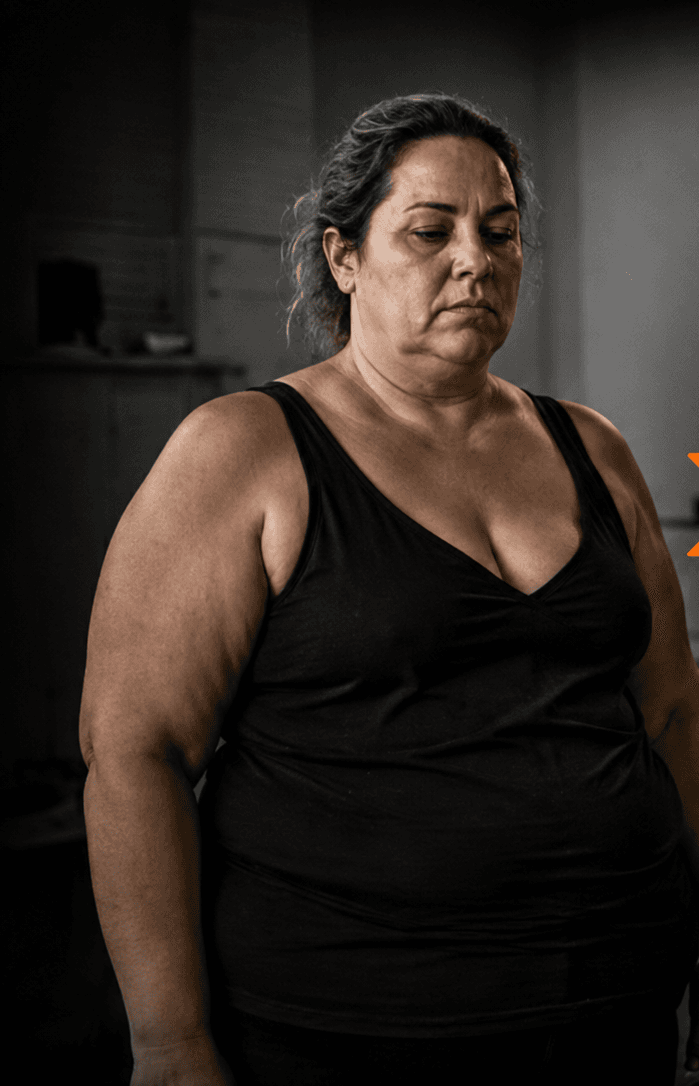 Mulher antes de iniciar o Método 90X